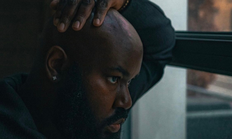 What's the deal with hair loss?
