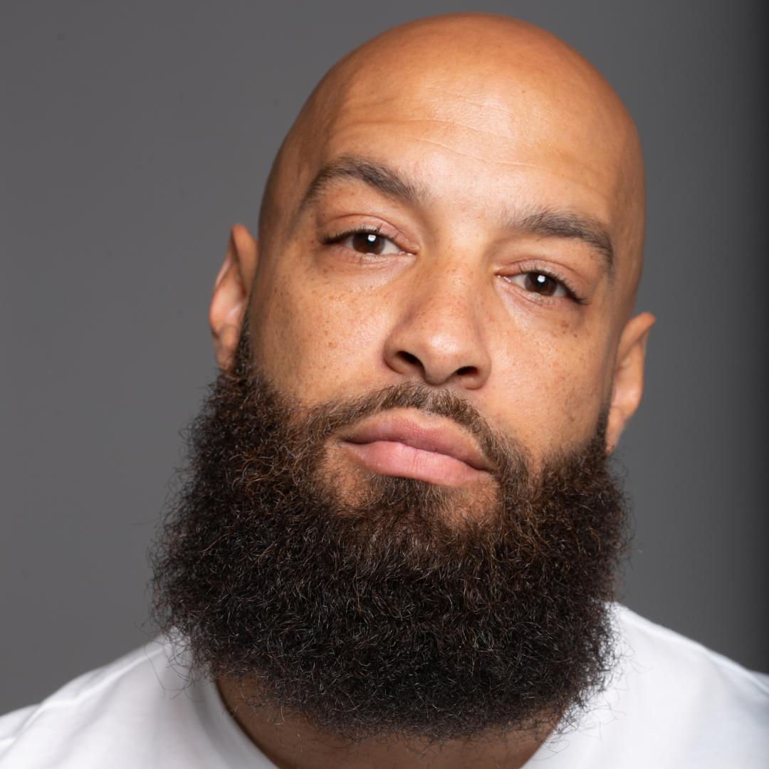 How to Get Rid of Scalp Breakouts: A Bald Man's 3-Step Guide for Clear, Healthy Skin